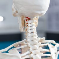 What Compensation Can You Recover for a Spinal Cord Injury or Electrical Accident?